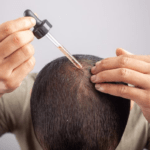 The Science of Hair Restoration: Why High-Potency Minoxidil is Changing the Game for Men